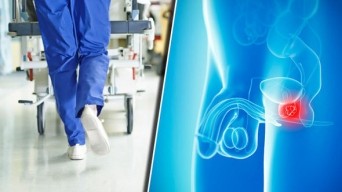 3 dạng ung thư nguy hiểm ở nam giới