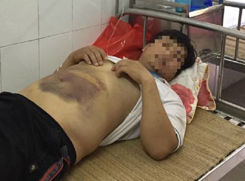 Hà Nội: Nhập viện cấp cứu sau khi công an mời lên làm việc