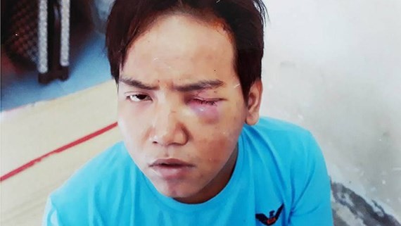 Bảo vệ dân phố ra tay sát hại bé trai. Ảnh: Zing