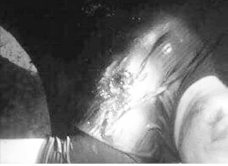 Vết đạn trên người nạn nhân. Ảnh: VietNamNet