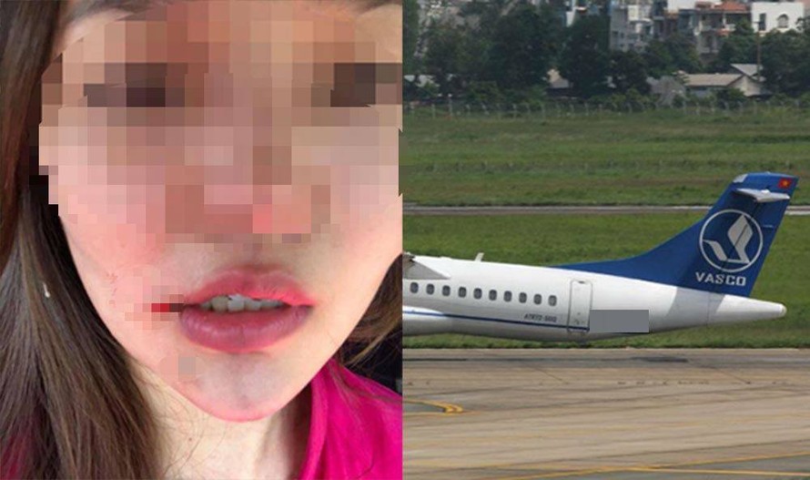 Tiếp viên H. bị chấn thương phần mềm. Ảnh: VietNamNet