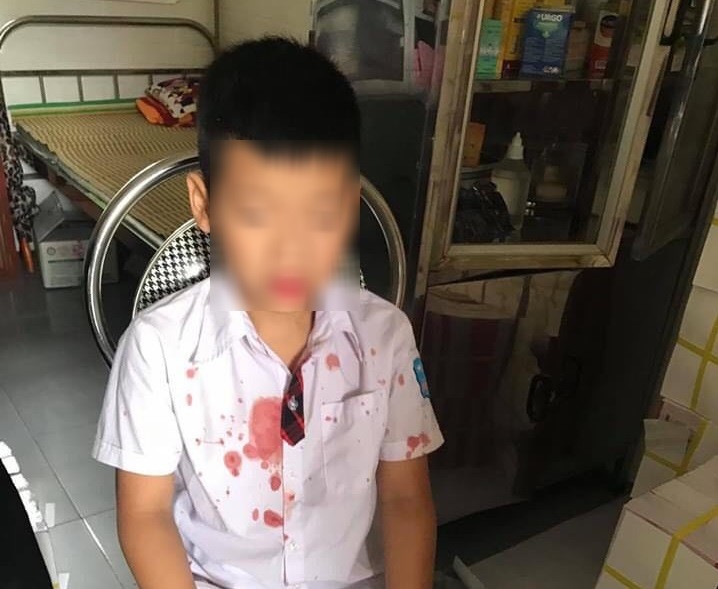 Cháu K. bị thương sau khi bị ông Đức hành hung.