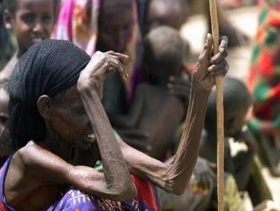 LHQ và các đối tác giúp đẩy lùi dịch tả, sốt rét và suy dinh dưỡng ở Ethiopia