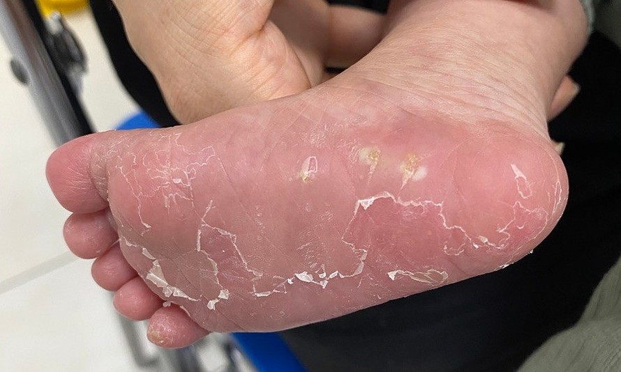 Số trẻ sơ sinh ở Nhật Bản bị bệnh giang mai cao đáng báo động