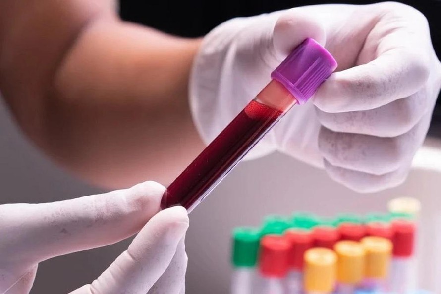 Chưa có bằng chứng khoa học về lọc máu có thể phòng ngừa các bệnh liên quan đến mỡ máu, đột quỵ