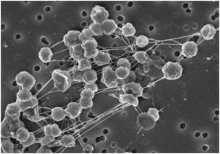 Phát hiện cơ chế giúp sinh vật “chịu nhiệt” sống sót trong môi trường khắc nghiệt