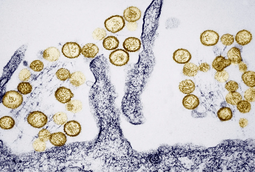 Những điều cần biết về virus Hanta