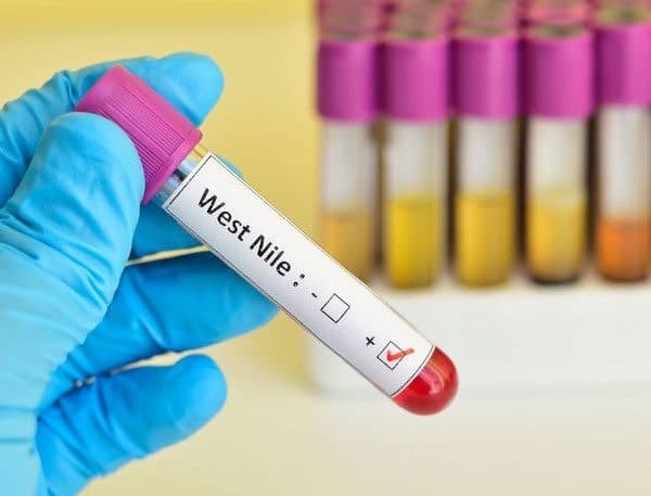 Dịch virus Tây sông Nile lan rộng tại Italy