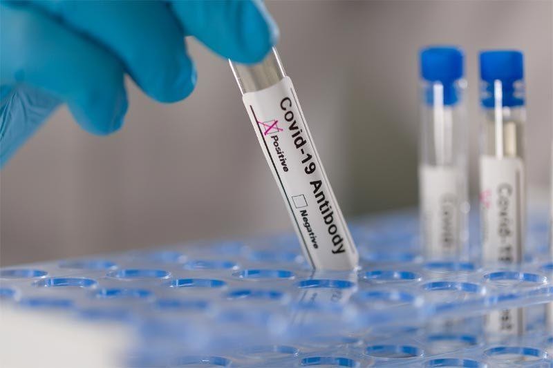 Trung Quốc tuyên bố phát hiện kháng thể ngăn ngừa được mọi biến thể của virus SARS-CoV-2