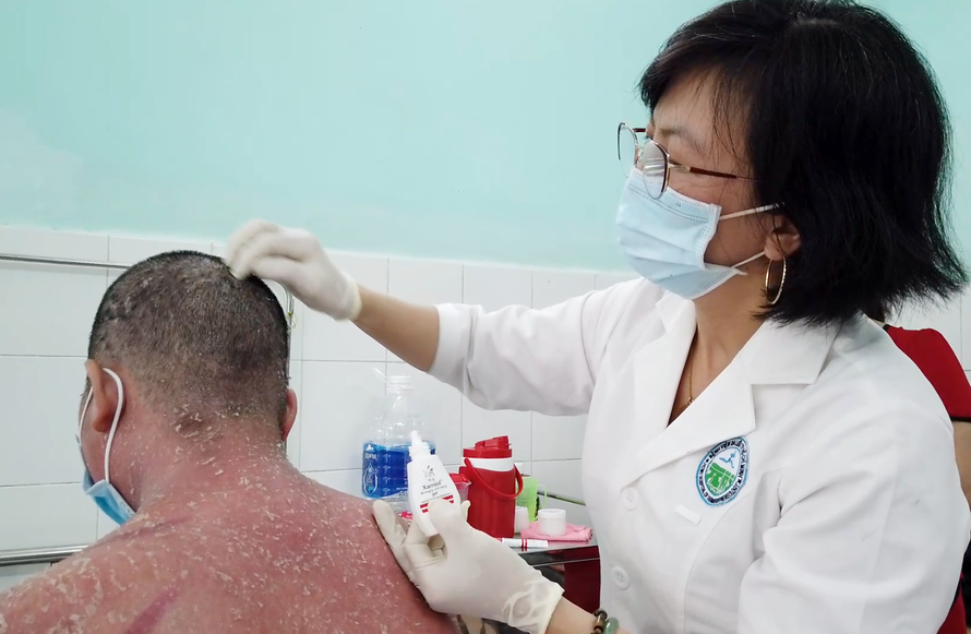 Nhiều trường hợp nhập viện do sử dụng thuốc chữa vảy nến trên mạng