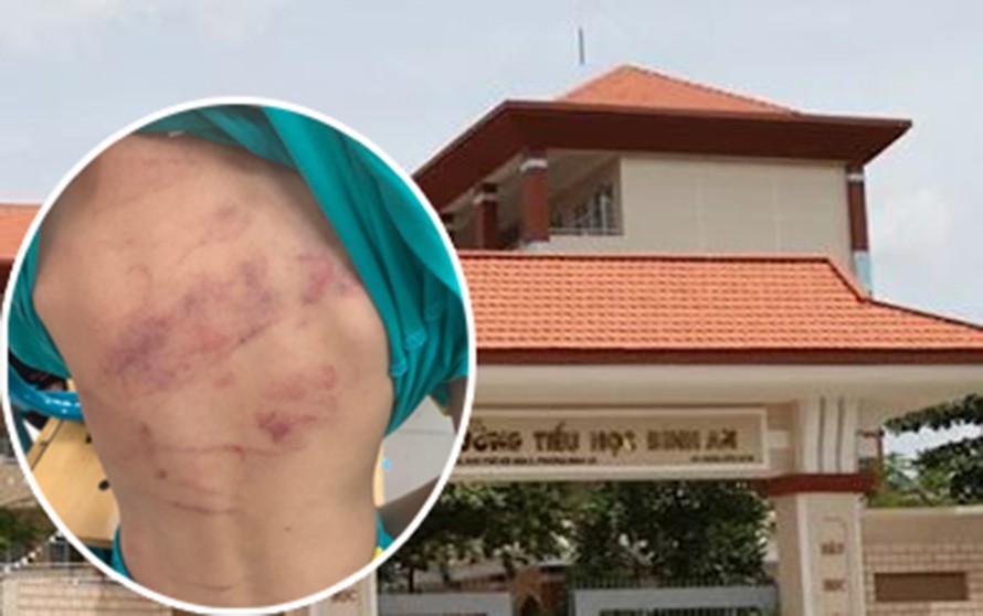 Trường Tiểu học Bình An và học sinh lớp 1 bị bạn đánh (ảnh nhỏ).