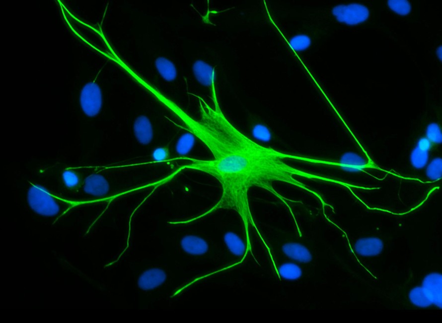 Điều trị sang chấn và lo âu bằng tế bào não