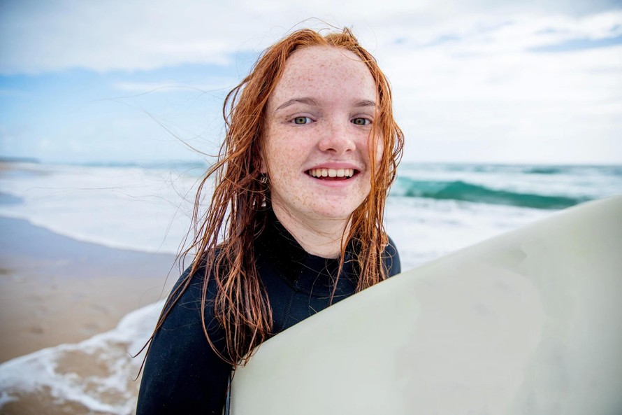 Gen tóc đỏ được tự nhiên “ưu ái” trong suốt 10.000 năm tiến hóa