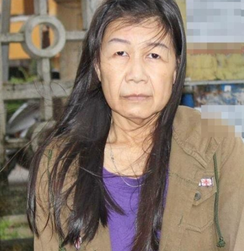 Nguyễn Thị Như trước và sau khi phẫu thuật thẩm mỹ.