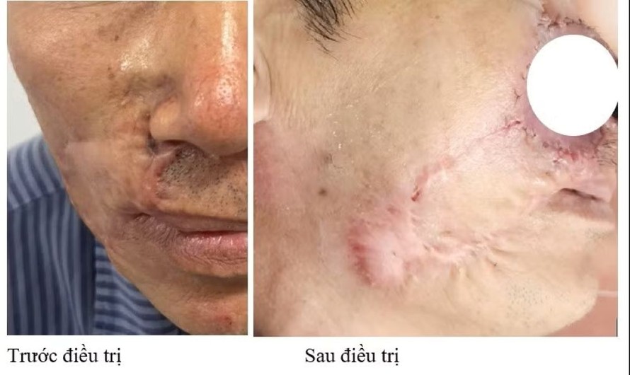 Hình ảnh bệnh nhân trước và sau điều trị.