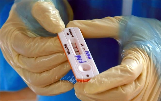 Người đã nhiễm chủng Omicron vẫn có thể tái nhiễm lần nữa với chính Omicron, nhưng với biến thể phụ khác. Ảnh: TTXVN.