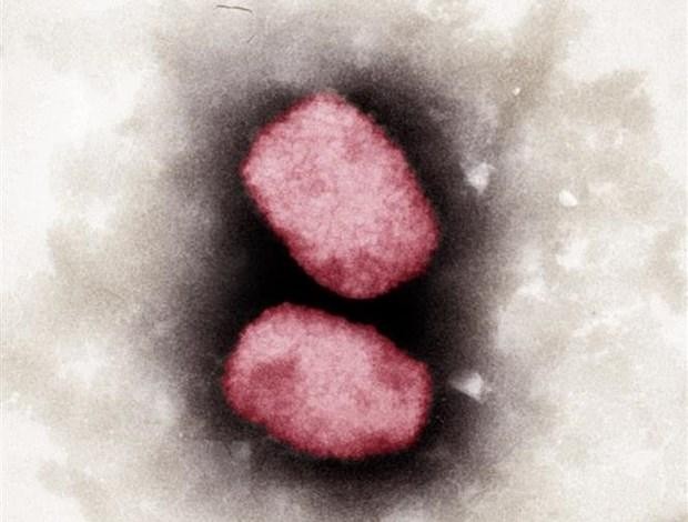 Virus đậu mùa khỉ nhìn dưới kính hiển vi. (Ảnh: AFP/TTXVN)